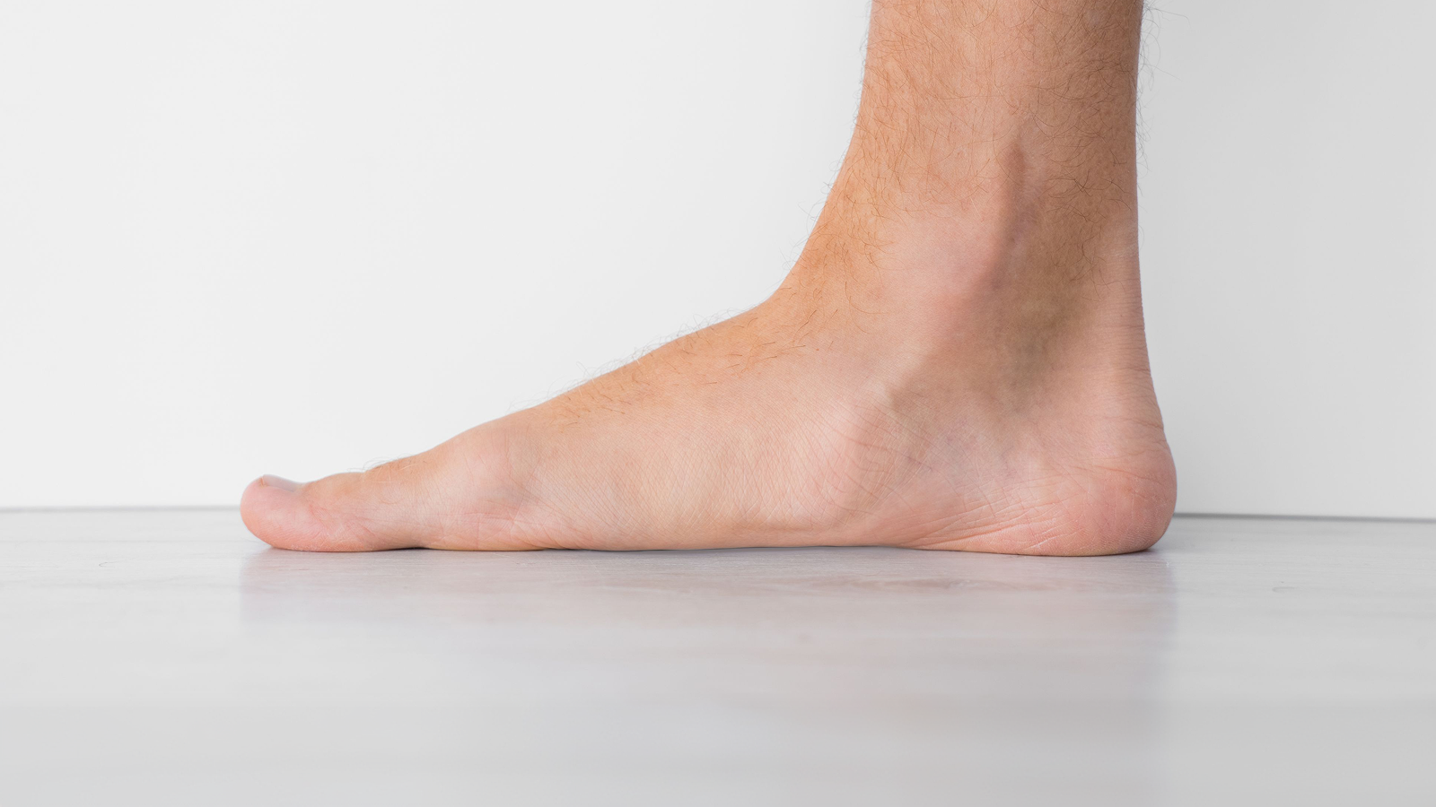 Người có bàn chân bẹt (Flat Feet)
